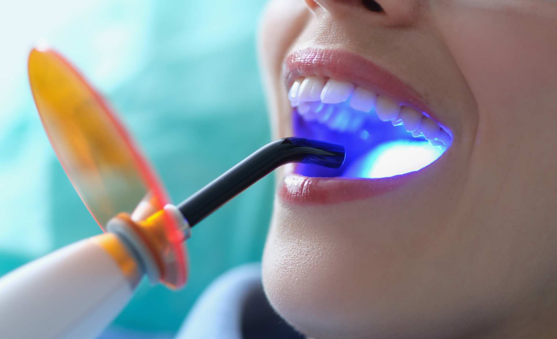 01 A dentist using UV rays to whiten a patient's teeth