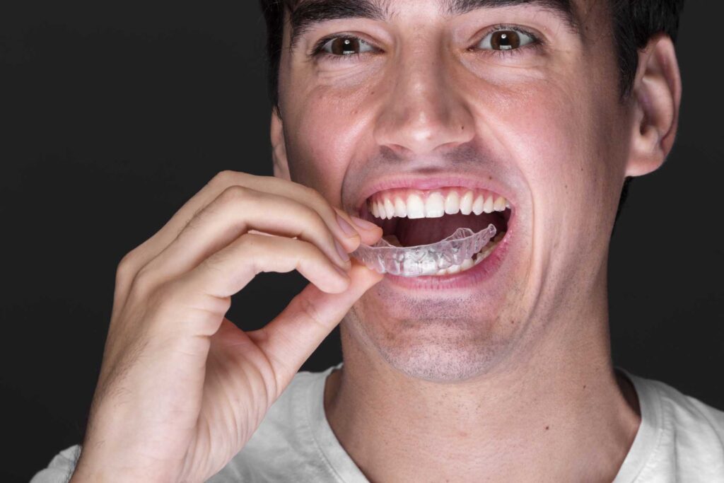 05 Close up of a man putting on an upper dental brace