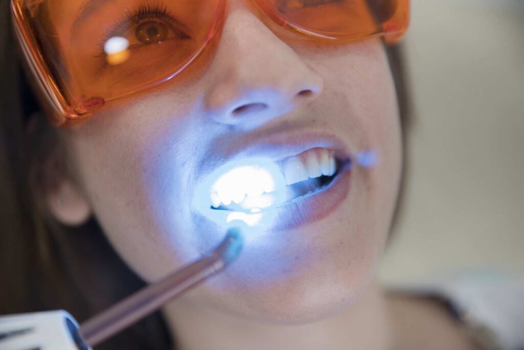 06 A patient wearing protective goggles during a laser teeth whitening treatment in a clinic.