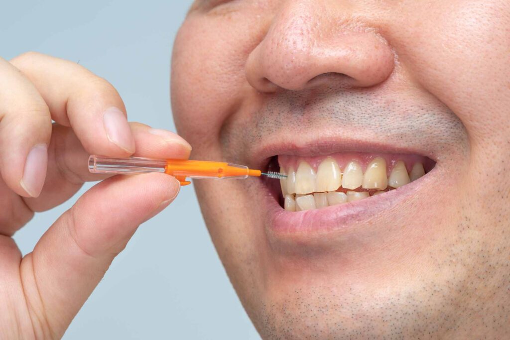 06 Man cleaning his incisor teeth with an interdental brush