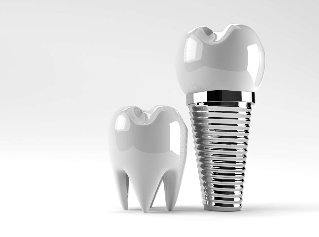 07 3D mock-up of a tooth and a dental implant with crown on a neutral background_How long after dental implants can I eat no
