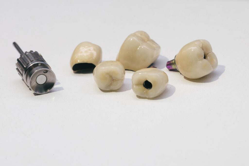 07 Zirconia dental crowns ready to be placed on dental implants_Dental implants pros and cons, dental implants in Miami