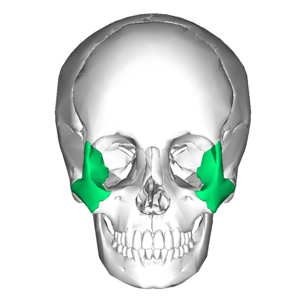 10 Illustration of a human skull with the zygomatic bones of the face indicated in green_Author Anatomography from Wikimedia