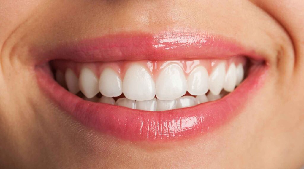 03 Closeup of a white smile dental bridges vs dental implants